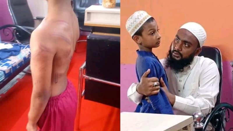 নরসিংদীতে মাদ্রাসা শিক্ষকের প্রহারে ৭ বছরের শিশু রক্তাক্ত; ভর্তি হাসপাতালে